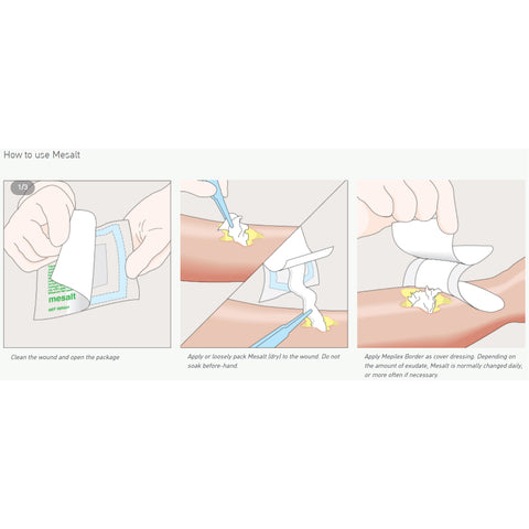Molnlycke Sodium Chloride Impregnated Dressing Mesalt® Square 8 X 8 Inch / 4 X 4 Inch Folded Sterile #286080