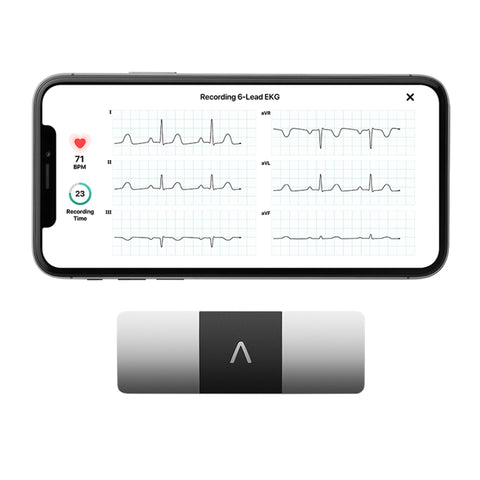 Electrocardiograph KardiaMobile® USB Connection Smart Phone Display Resting #AC-019-NUA-A