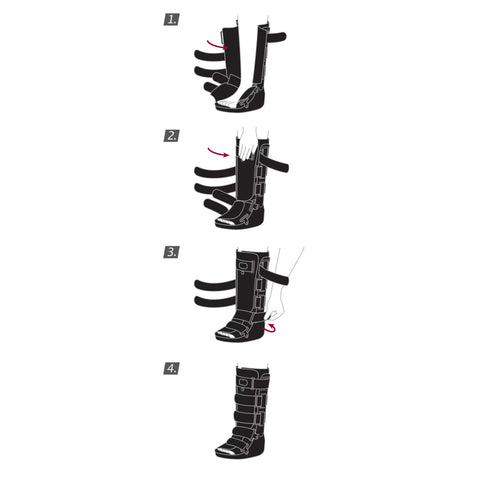 Air Walker Boot Actimove® Pediatric / Adult Small Short #7627251