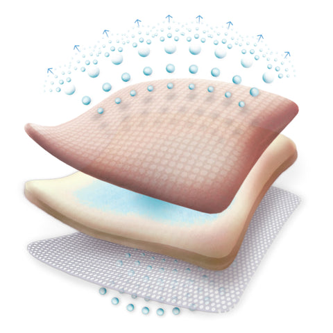 Smith & Nephew Foam Dressing Allevyn Adhesive 5 X 5 Inch With Border Film Backing Adhesive Square Sterile #66020044
