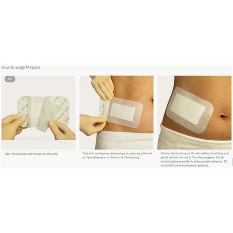Adhesive Dressing Mepore® Nonwoven Spunlace Polyester Rectangle White Sterile