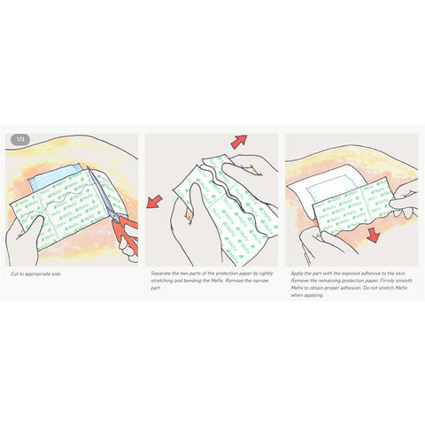 Dressing Retention Tape with Liner Mefix® Perforated Liner Nonwoven Spunlace Polyester White NonSterile