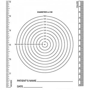 Stradis Healthcare Wound Measuring Device