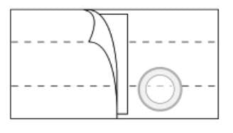 Peristomal Hernia Belt Nu-Form™ Large 7 Inch Width