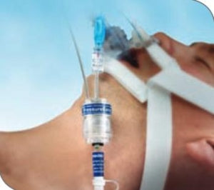 Quickstrap Endotracheal Tube Holders