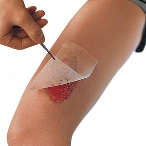 Cuticerin Gauze Dressings