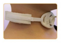 Pediatric Tracheostomy Collars